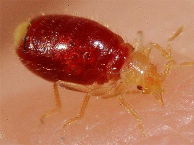 What do bedbug bites look like on a human body?